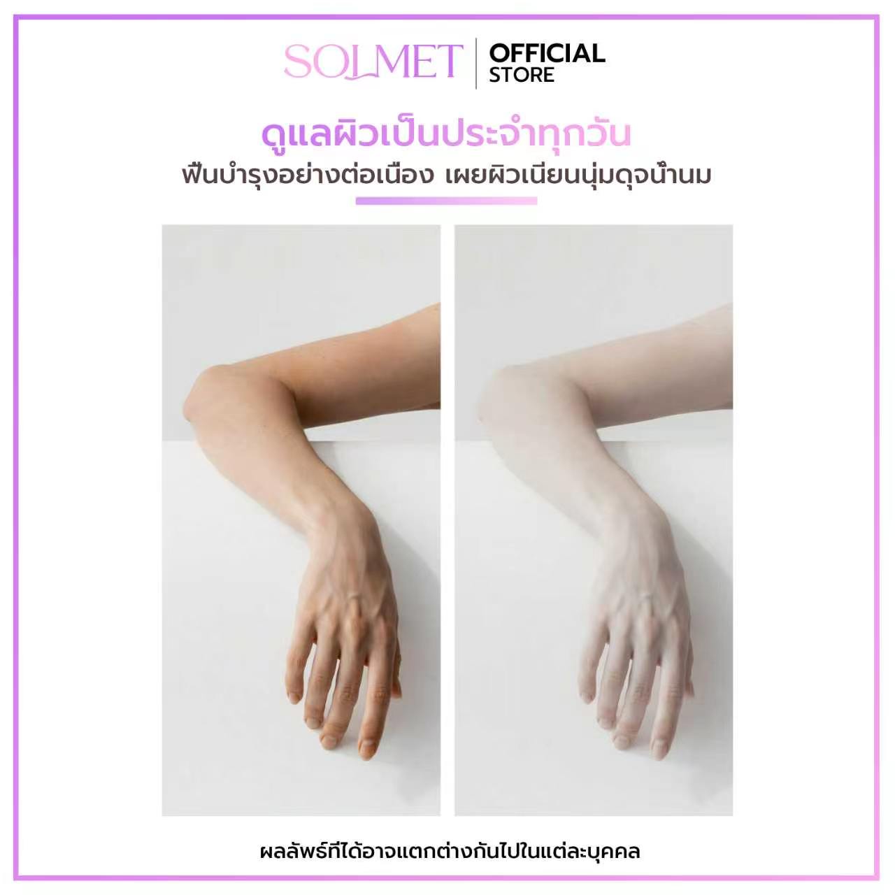 Before After Skin Comparison
